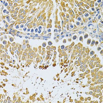 Immunohistochemistry - PIBF1 Antibody (144-03072)