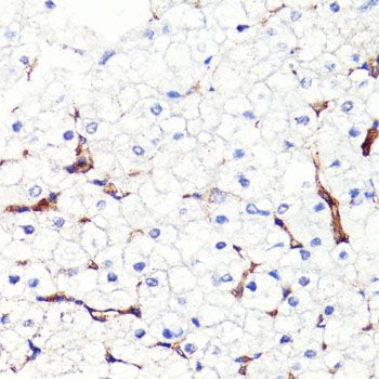 Immunohistochemistry - CD44 Polyclonal Antibody (144-00340)