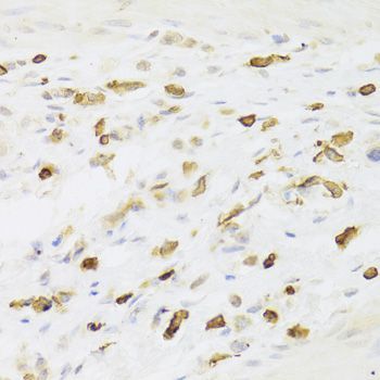 Immunohistochemistry - LSP1 Antibody (144-05617)