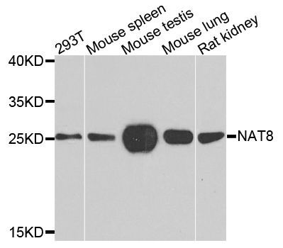 Western blot - NAT8 antibody (144-07759)