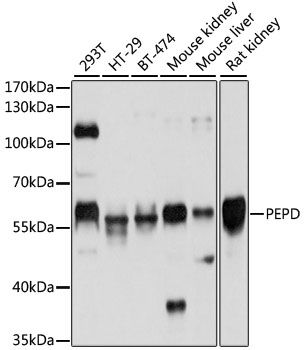 Western blot - PEPD antibody (144-05416)