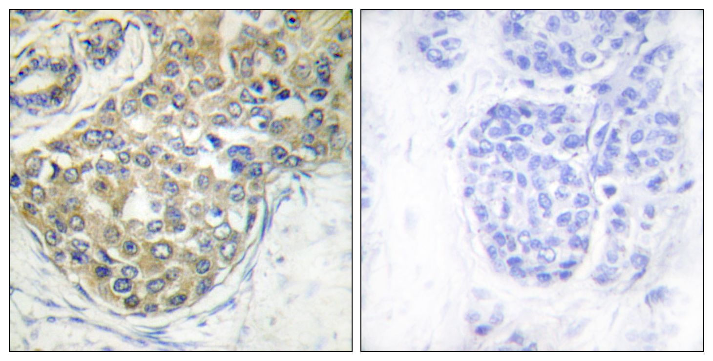 IHC