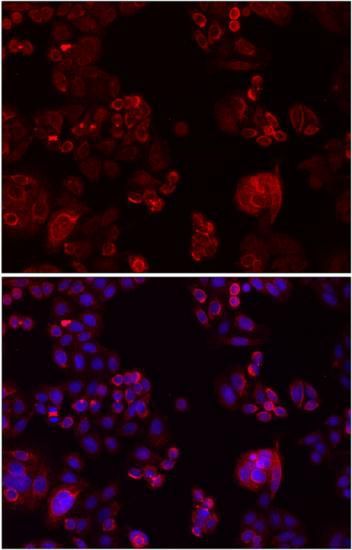 Immunofluorescence - fluorescence analysis of SW480 cells showing nuclear and cytoplasmic localization with NOTCH3 antibody (144-03115)