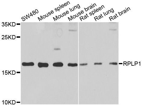 Western blot - RPLP1 Polyclonal Antibody (144-06725)