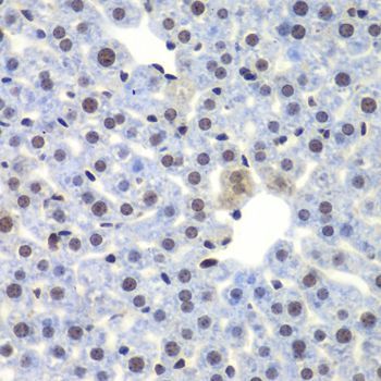 Immunohistochemistry - CEBPG Polyclonal Antibody (144-07279)