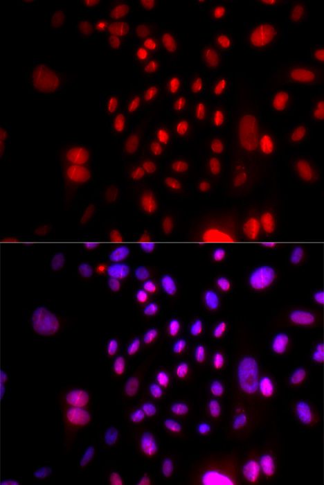 Immunofluorescence - RFC4 Polyclonal Antibody (144-05485)