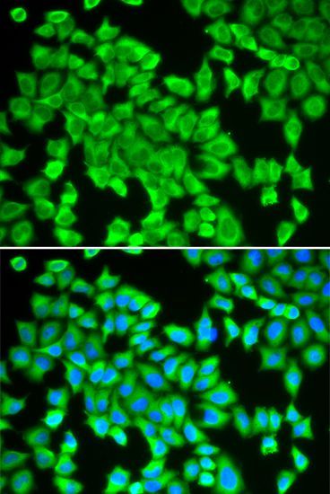 Immunofluorescence - STIP1 antibody (144-01219)
