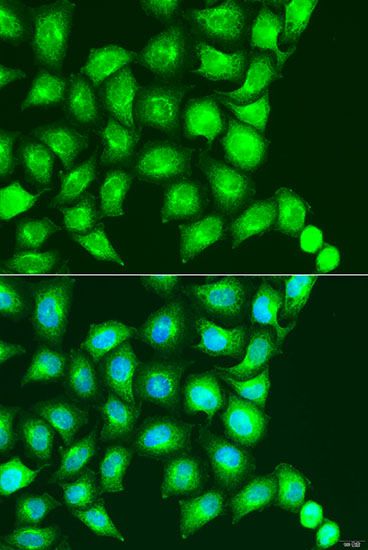 Immunofluorescence - UBIAD1 antibody (144-07640)