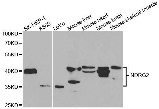 Western blot - NDRG2 Polyclonal Antibody (144-05319)
