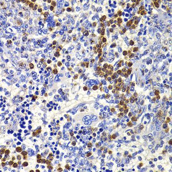 Immunohistochemistry - IL21 antibody (144-07235)