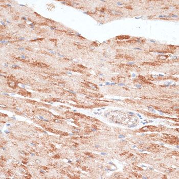 Immunohistochemistry - KIR3DL3 Polyclonal Antibody (144-10064)