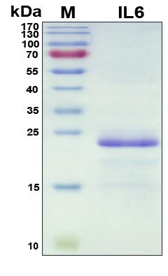 SDS-PAGE