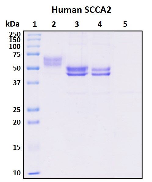 SDS-PAGE