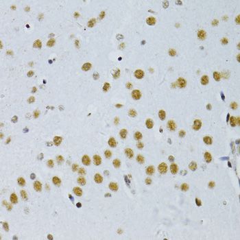 Immunohistochemistry - SNRNP70 antibody (144-06065)