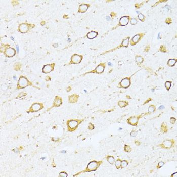 Immunohistochemistry - HSPA5 Polyclonal Antibody (144-011366)