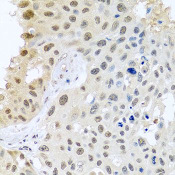 Immunohistochemistry - DNAL1 antibody (144-08267)