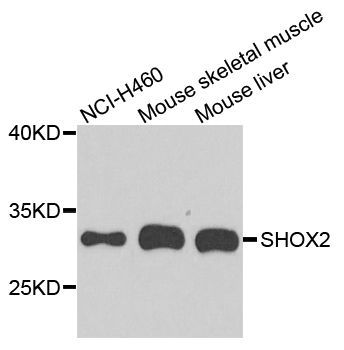 Western blot - SHOX2 antibody (144-08309)