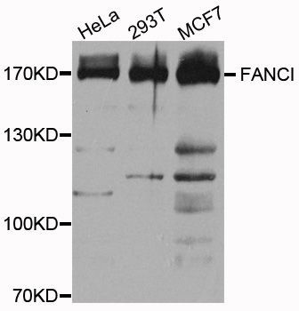 Western blot - FANCI Polyclonal Antibody (144-03447)