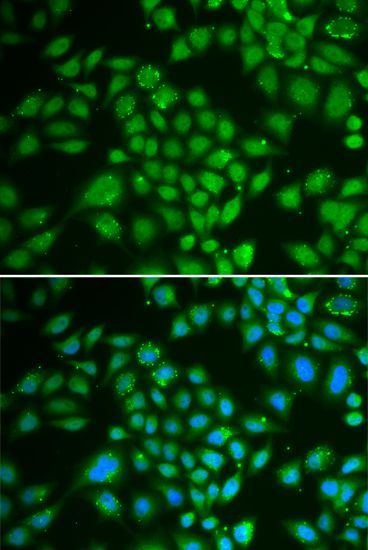 Immunofluorescence - DCK antibody (144-01794)