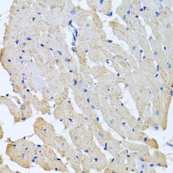 Immunohistochemistry - GPLD1 Polyclonal Antibody (144-06612)