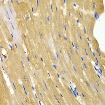 Immunohistochemistry - AK1 Polyclonal Antibody (144-01218)