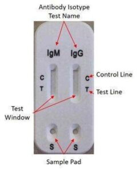 The different part of lateral flow technology uses to detect COVID-19 IgM and IgG antibodies.