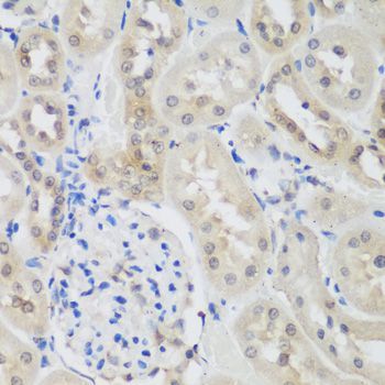Immunohistochemistry - UBE3A antibody (144-01757)
