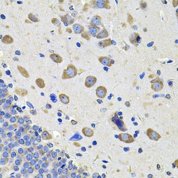 Immunohistochemistry - GALNT2 Antibody (144-06910)