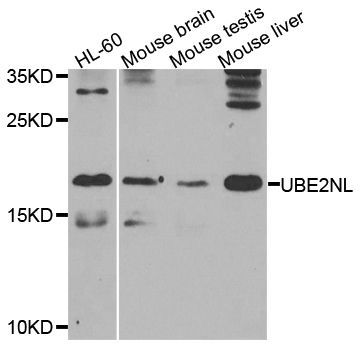 Western blot - UBE2NL Polyclonal Antibody (144-08381)