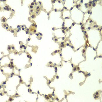 Immunohistochemistry - FBXW11 antibody (144-07784)