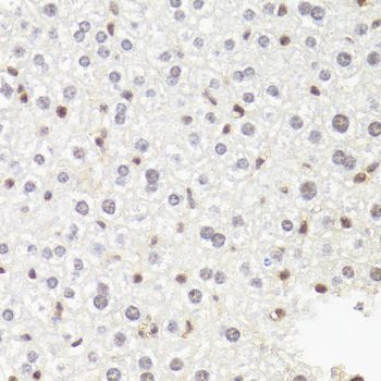 Immunohistochemistry - POLR2B Polyclonal Antibody (144-05928)