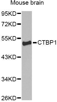 Western blot - CTBP1 Antibody (144-01707)