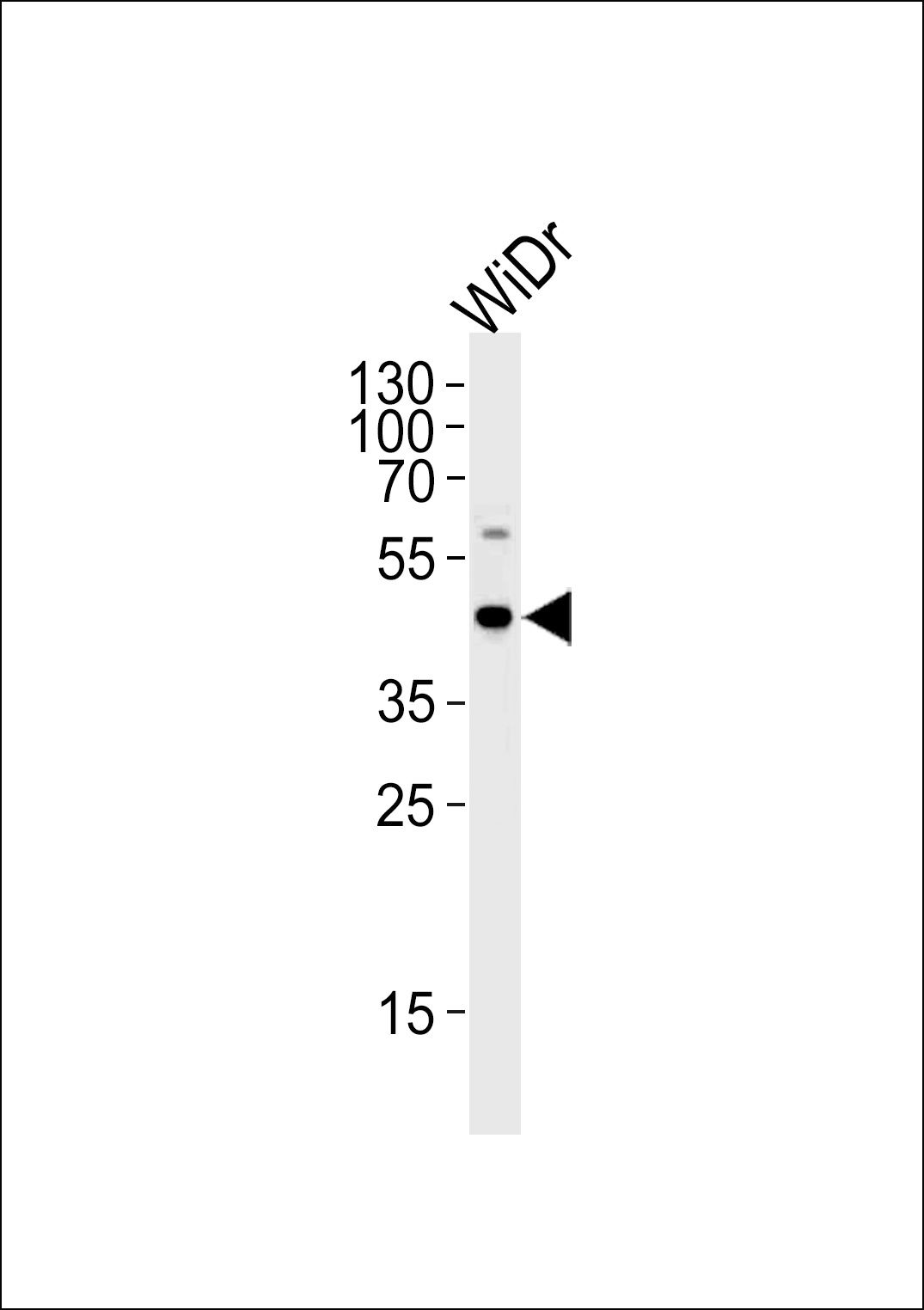 WB