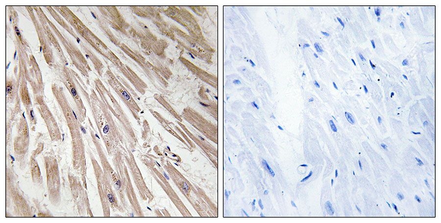 IHC
