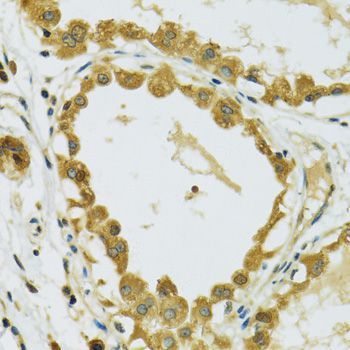 Immunohistochemistry - RPS7 Polyclonal Antibody (144-06731)