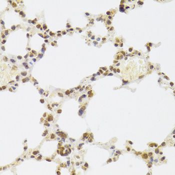 Immunohistochemistry - XRCC6 Polyclonal Antibody (144-00883)