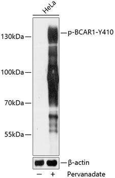 Western blot