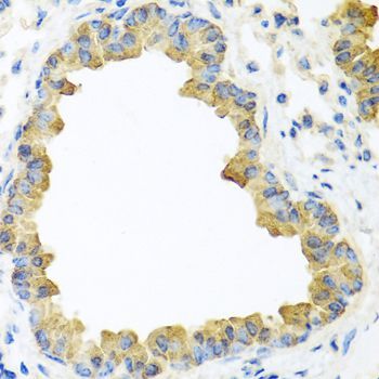 Immunohistochemistry - WNT5B Polyclonal Antibody (144-08313)