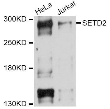 Western blot - SETD2 Antibody (144-011757)