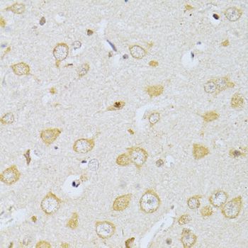 Immunohistochemistry - CHRNA7 antibody (144-01588)