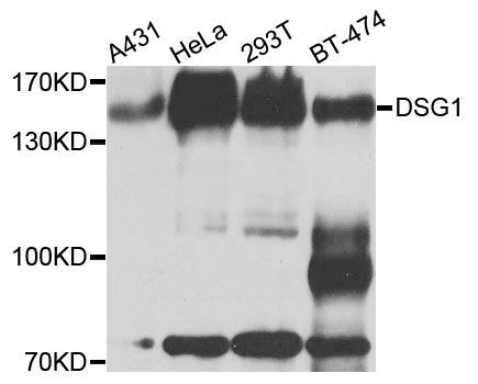 Western blot - DSG1 Polyclonal Antibody (144-09812)