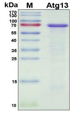 SDS-PAGE