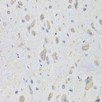 Immunohistochemistry - [KO Validated] EEF1B2 Polyclonal Antibody (144-06580)