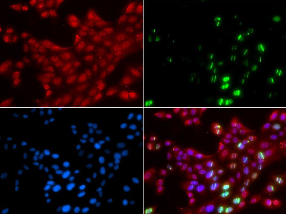Immunofluorescence - TP53BP1 antibody (144-05757)