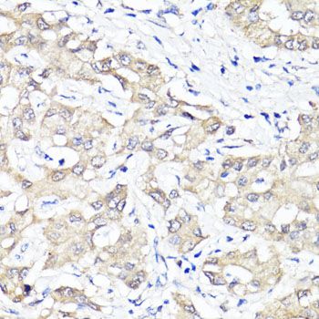Immunohistochemistry - [KO Validated] YAP1 Polyclonal Antibody (144-01002)