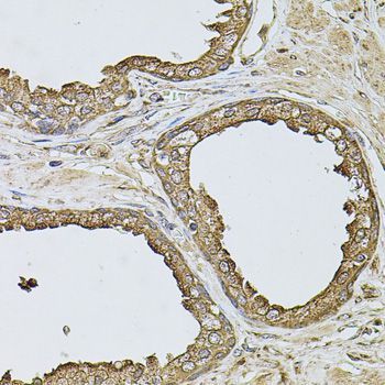 Immunohistochemistry - ANXA8L2 antibody (144-07641)