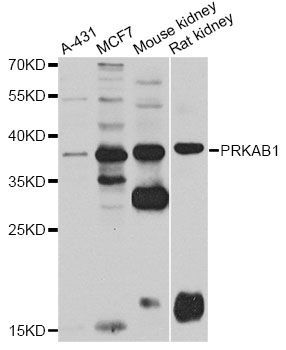Western blot - PRKAB1 antibody (144-07921)
