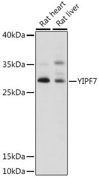 Western blot