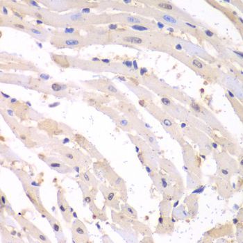 Immunohistochemistry - PSMB1 Polyclonal Antibody (144-01043)