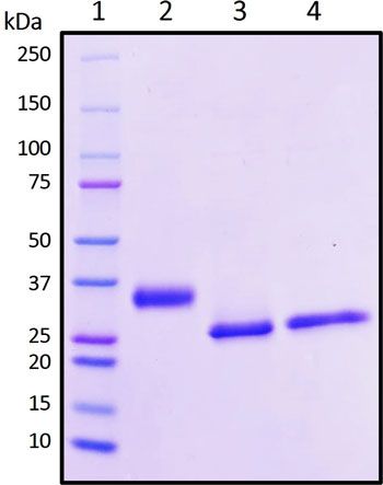 SDS-PAGE